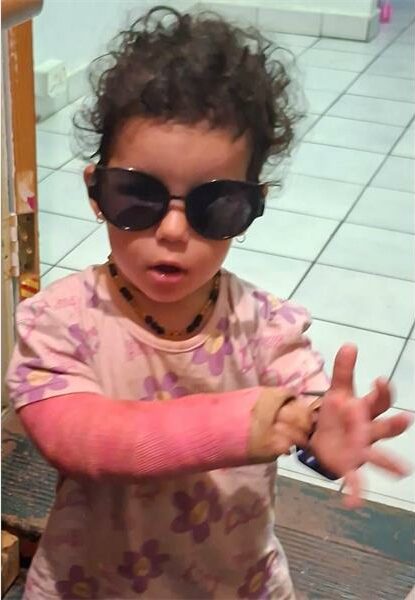 little girl with a cast on her arm