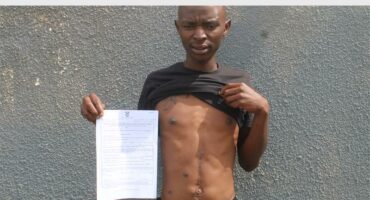 man with pulled up shirt points to scars on his stomach . he also has a paper in his hand